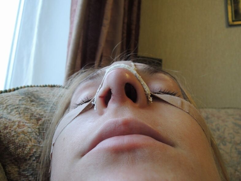 реабілітація