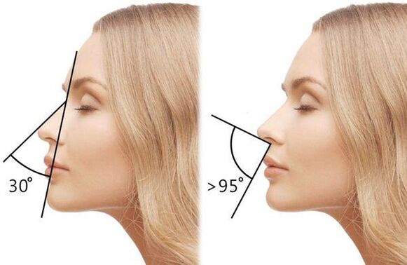 вимір кута носа