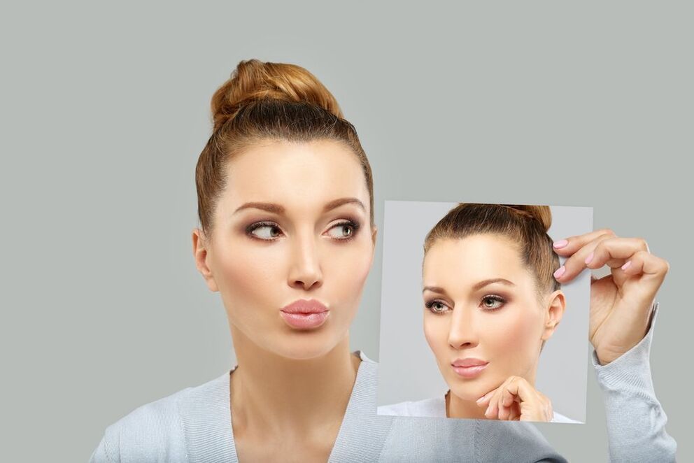 обличчя жінки до та після ринопластики